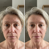 Huevia™ - Line Smoother Perfect Skin in 3 Minutes